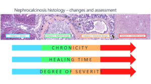 PatoGen Nephrocalcinosis histology